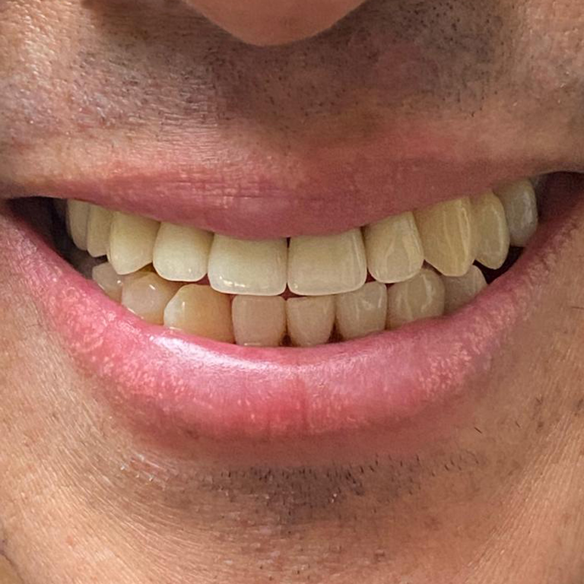 neue Brücken-Ästhetik